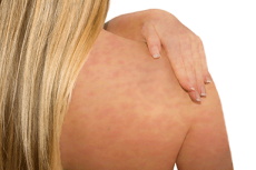 diagnose skin rash